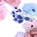 Δοκιμασία οξικού οξέως: